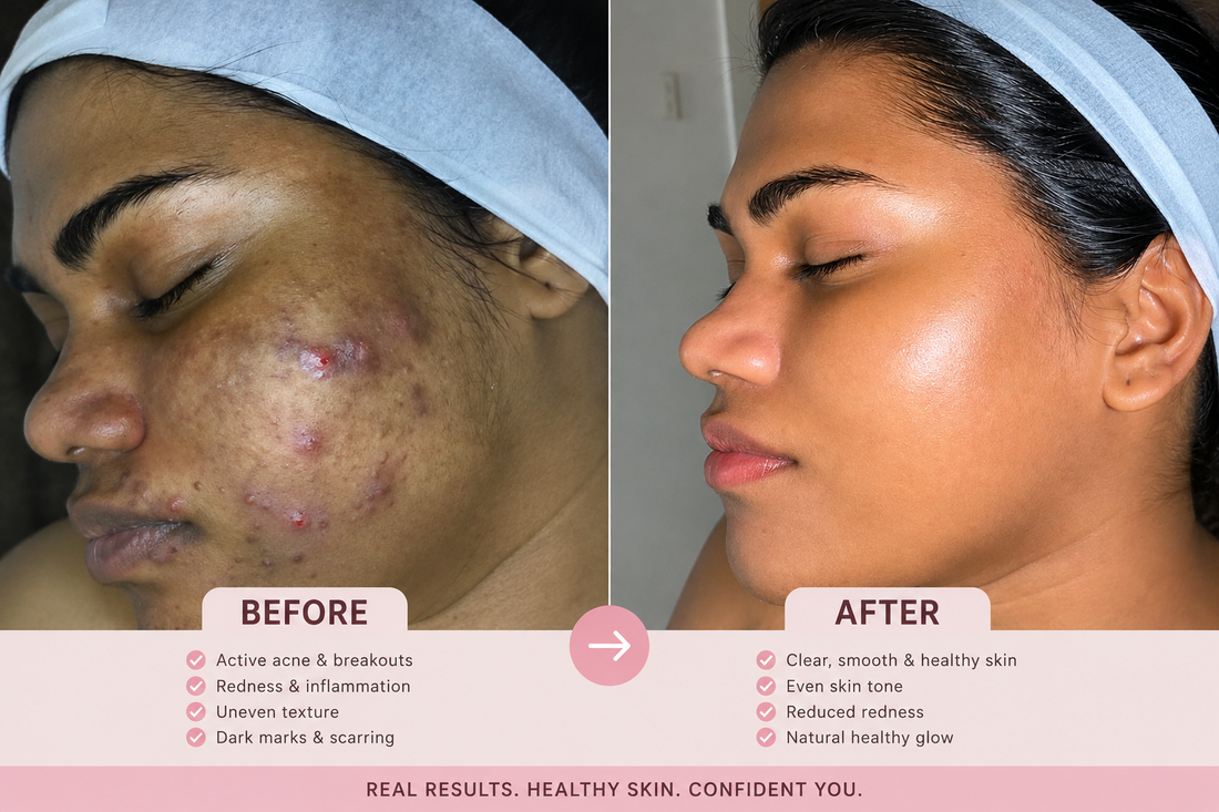 What Is Glass Skin? | Korean Skincare Guide | Glass Skin